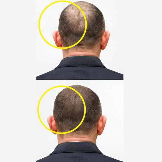 Masofta Hair Growth Serum For Promoting Hair Growth & Controlling Hair Fall